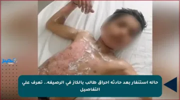 حالة استنفار بعد حادثة إحراق طالب بالكاز في الرصيفة.. تعرف على التفاصيل‫